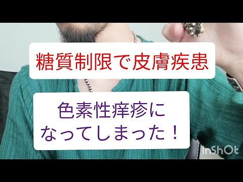 糖質制限で皮膚疾患になってしまった体験談。色素性痒疹ってやつでした。