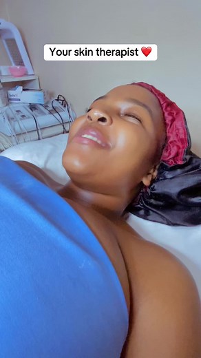 #fyp #extremeskinsations #hyperpigmentation