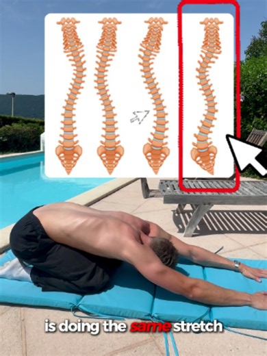 Scoliosis stretch & exercise progression plan