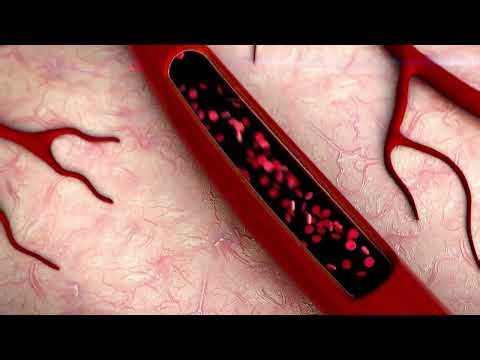 PEMF Therapy and Circulation