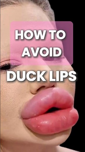 💋 How to Avoid Duck Lips