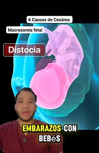 47K views · 421 reactions | ¿Estás embarazada y te preocupa si te...