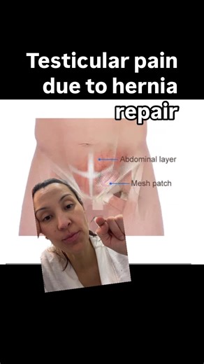 Experiencing groin and testicular pain after a hernia repair is a relatively common complication, often caused by facial and muscular contraction, and sometimes involvement of your genitofemoral cutaneous nerve that can lead a painful sensation into the testicle, even though the nerve itself is coming from the lower back. #nervepain #groinpainrelief #groinpain #testicularpain #testicles #testicle #hernias #herniarepair #inguinalhernia | Pelvic Health NJ