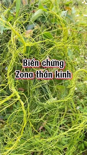 Complications after shingles: pain, itching, burning, and stinging inside the body. #shortvideo