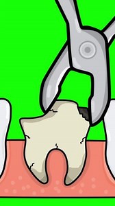 Download Tooth Extraction Dental Medical Animation Vertical Green Screen for free