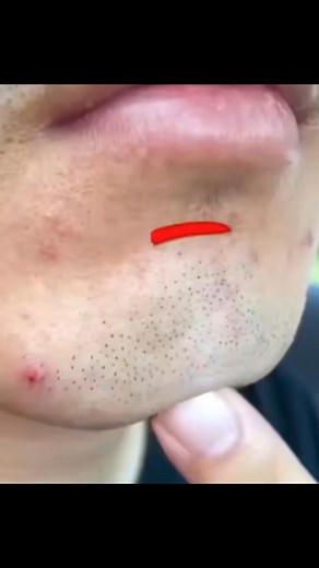 ⚠ Arrêtez d’utiliser les rasoirs traditionnels ! Ils provoquent coupures, irritations, boutons et poils incarnés sur la peau. Résultat ? Des démangeaisons, des brûlures et une peau abîmée à force de rasages répétés 😣 💡 La solution : le mini rasoir électrique de nouvelle génération Conçu pour la barbe et les parties intimes, il offre un rasage rapide, précis et sans douleur. Ses lames rotatives haute précision glissent en douceur sur la peau sans la blesser. 💎 Résultat En quelques secondes, vo