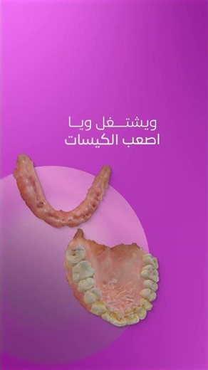Runyes Intraoral Scanner V5 & V6 | Digital Dentistry Solutions
