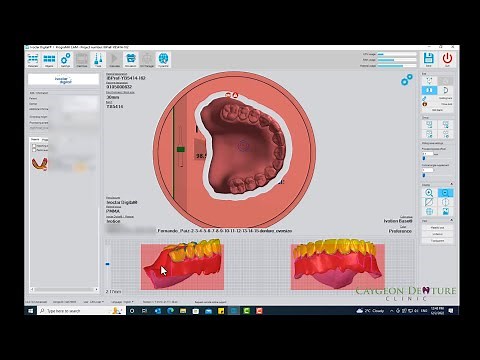 Nesting CUD-CLD for Milling on Ivoclar's PM7