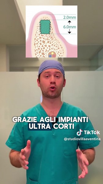 Impianti Bicon SHORT®️: la Soluzione per Poco Osso