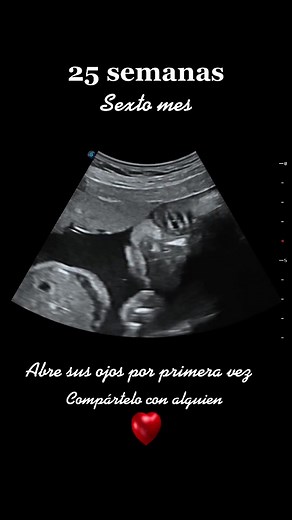 Ultrasonido 25 Semanas de Embarazo: Desarrollo Fetal