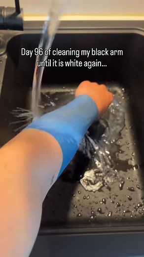 Day 96 of cleaning my black arm until it is white again… | Arm Brusher