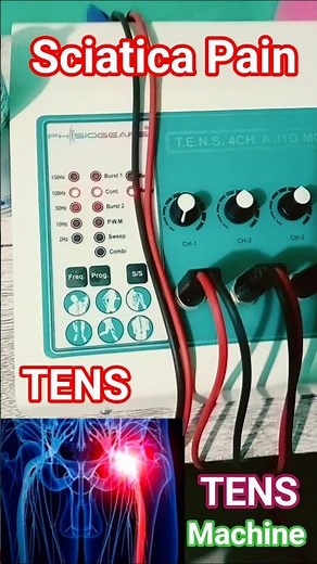 Sciatica Pain l Physiotherapy Treatment l Excercise l TENS Machine