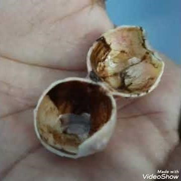 Human eye dissection