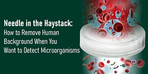 Needle in the haystack: How to remove human background when you want to detect microorganisms | Microbiology