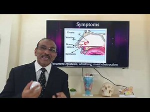 Septal perforation (Hindi) Patient teaching programme