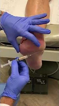 Fat Pad Injection using Leneva