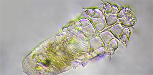 Skin mites explained: harmless passengers or health problem?