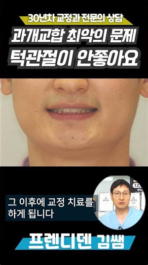 이런 경우 턱관절이 정말 안좋아집니다!! #부정교합 #턱관절장애 #턱관절통증 #과개교합 #교정전문의