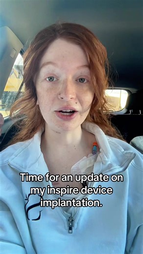 One month post op on my inspire device implantation to treat sleep apnea. Here’s how it’s going!