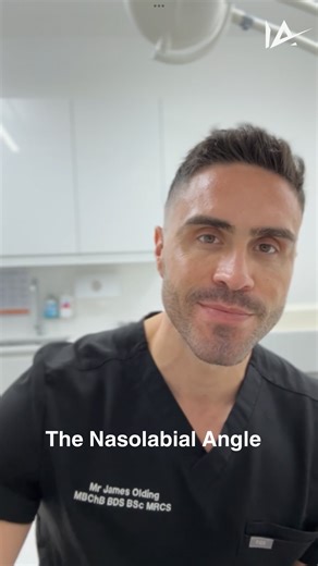 Interface Aesthetics | The nasolabial angle is a key element in facial profile assessment but it’s not a single structure. It’s formed by both nasal (columellar)... | Instagram