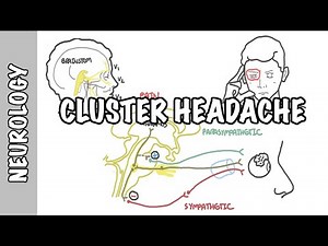 Cluster Headaches - symptoms, pathophysiology, treatment • Video • MEDtube.net