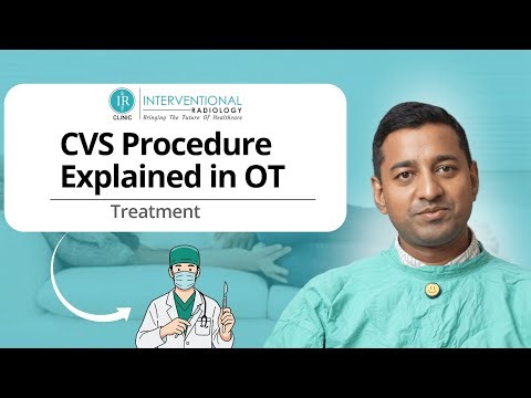 CVS Procedure Explained in OT | Dr Pankaj Goyal | IR Clinic Bhopal
