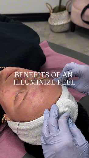 ✨Benefits of an Illuminize Peel ✨ 🌟Instant Radiance ⏳No downtime 🌈Brightens & evens tone 💖Safe for all skin types 💫Smooths & refines texture Buy an Illuminize Peel this month and get a FREE Dermaplane! The perfect amount of exfoliation as the summer months come to an end, leaving your skin fresh, smooth, and ready for fall. 🍂 | SkinFusion FX
