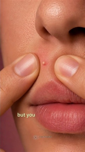 Never Pop a Pimple in This Part of Your Face