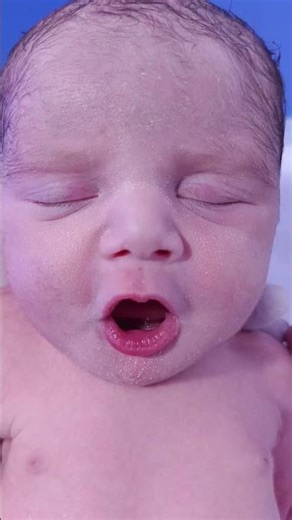 Cute Little Preterm Newborn Baby in NICU 🙏🩷