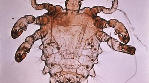 Păduchii laţi, pe cale de dispariţie. "Lăţeii" trăiesc un adevărat "dezastru de mediu", spun doctorii