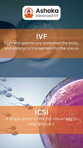 🔬 IVF vs. ICSI: Understanding the Key Differences in Fertility Treatments 💡 When it comes to fertility treatments, IVF and ICSI are both effective options, but they have distinct differences. 🌱 In IVF, eggs and sperm are combined naturally in the lab, and the resulting embryo is transferred into the uterus. 🥚💫 This method is commonly used for tubal issues, endometriosis, or unexplained infertility. On the other hand, ICSI involves injecting a single sperm directly into an egg to aid fertili