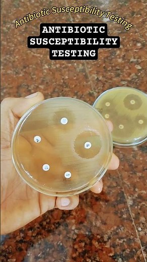Antibiotic susceptibility testing by kirby baeur disc diffusion method #AST #antibioticsensitivity