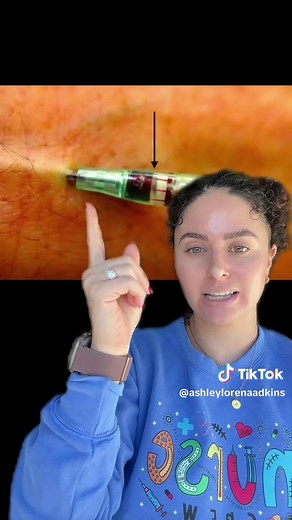 Have you ever placed IV into an artery on accident? If you do… Do not panic… And here’s what you need to know. 🚨 #arteriallines #ivs #icunurse #ernurse #nursingstudent