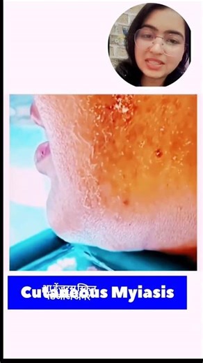 I Found WHAT in My Face?! (You WON'T Believe It) #shorts