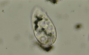 【观察】四膜虫(Tetrahymena)的运动与膜的流动