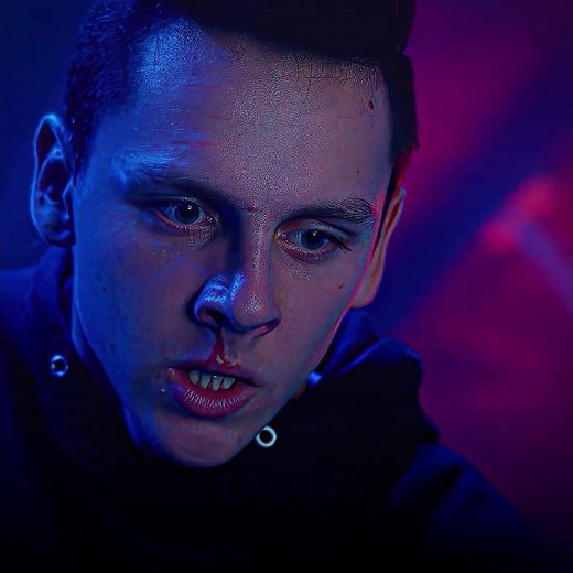 Hawk broke Demetris arm💀🥶