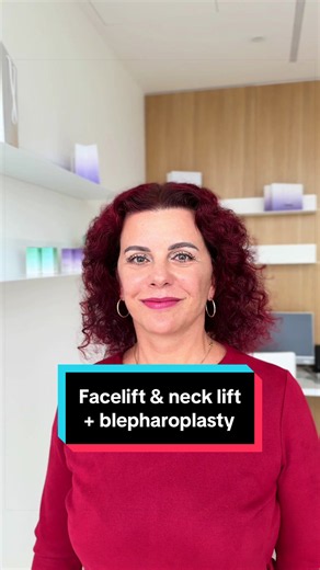 7 weeks after a deep plane facelift, deep neck lift and upper lower blepharoplasty ✨ The 55-year-old patient underwent the procedures under local anesthesia combined with analgosedation 💉 📲 If you want to make an appointment, contact us at contact@v-clinic.cz #facelift #necklift #blepharoplasty #plasticsurgery