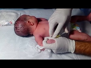 How to Receive & Stabilize a Newborn Baby from Labour Room | NICU Step-by-Step Recovery Care❣️❣️❣️