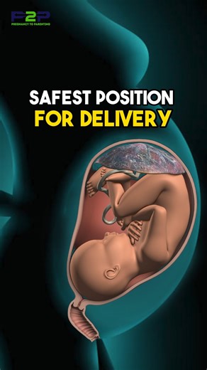 Pregnancy to parenting on Instagram: "The occipito-anterior (OA) position means your baby’s head is down, with the back of the head (the occiput) facing the front of your pelvis and the baby’s face toward your spine. This is considered the most ideal position for birth, as it allows the baby to align perfectly with the shape of the birth canal. In the OA position, the baby’s chin is tucked and the smallest diameter of the head leads the way, helping labor progress more smoothly and efficiently.