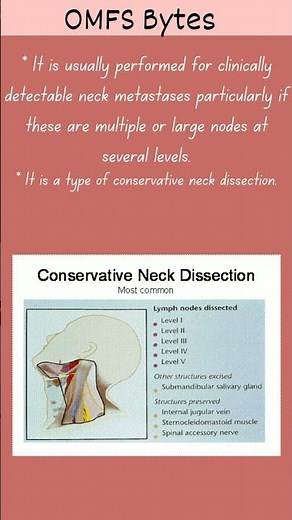 Modified Radical Neck Dissection (MRND), Neck Dissection, Oral and Maxillofacial Surgery Topics
