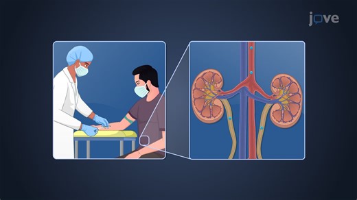 Video: Drug Dosing in Renal Diseases: Measurement of Serum Creatinine Concentration and Clearance