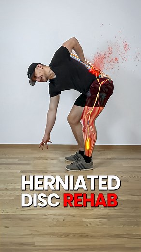5.7K views · 610 reactions | Herniated Disc?? Do This  A herniated...