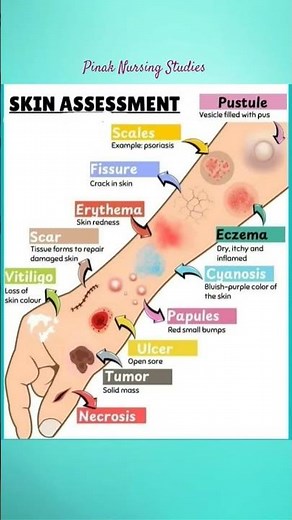 Skin assessment | Types of lesions