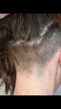 Start With an Undercut and Finish With a Chin Length Bob