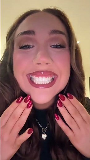 Invisalign before and after transformation