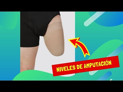 Tipos de Amputaciones (Pierna) - Niveles