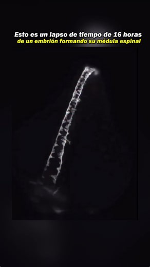 CienciaMania on Instagram: "16 horas de desarrollo resumidas en segundos. ⏳🧬 Así se forma el tubo neural, la estructura que dará origen al cerebro y la médula espinal. 🔬 De una simple lámina de células surge la arquitectura más compleja de la vida. 🌱✨"