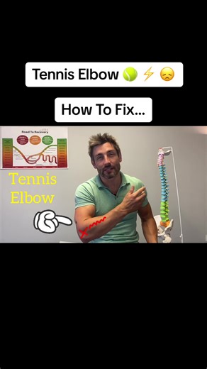 How to Fix Tennis Elbow: Comprehensive Guide