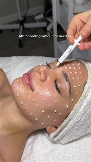 What if microneedling didn’t actually use needles? CELLSTORY’s formula uses microscopic spicules (naturally derived, needle-shaped structures) that create invisible micro-pathways on the surface of the skin. Unlike traditional microneedling, there are no metal needles, no puncturing, and no downtime — just precision delivery. These micro-pathways help guide active ingredients deeper and more efficiently, signaling the skin’s natural renewal process while supporting texture, tone, and overall ski