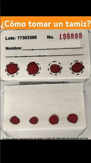 Cómo se toma una muestra para tamiz neonatal? #short #tomademuestra #tamizneonatal